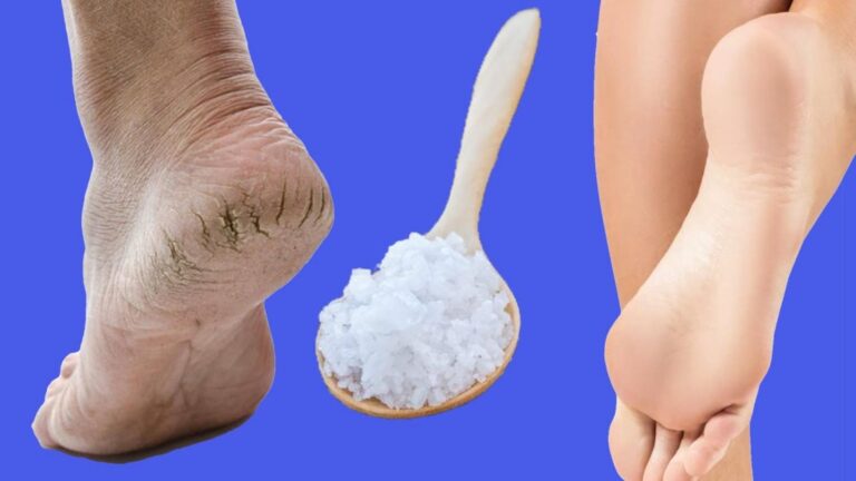 This simple method transforms cracked heels into baby-soft feet in no time…