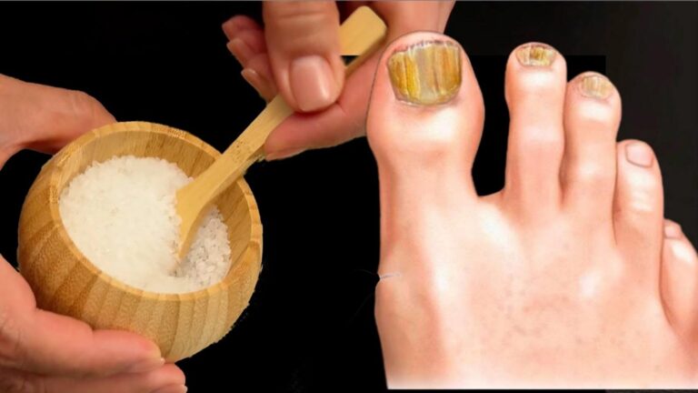 This simple remedy can transform your toenails and banish fungus for good…