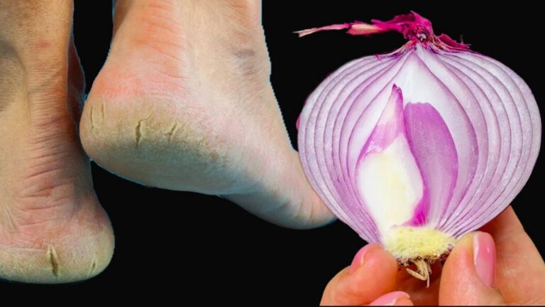 This forgotten trick transforms dry, cracked heels into soft, beautiful feet forever…