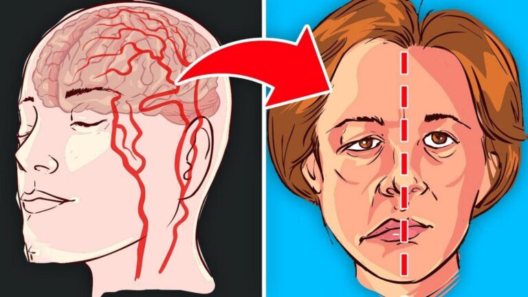 This simple food swap could dramatically lower your stroke risk…
