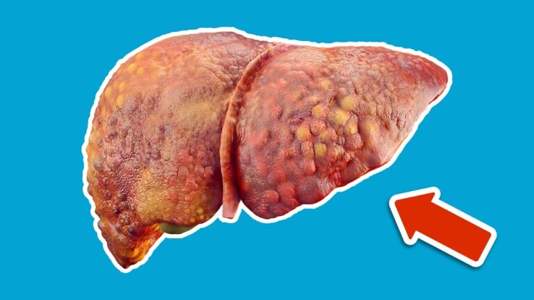 Avoid These 3 Liver Mistakes That Can Damage Your Health Today!