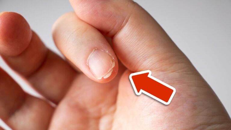 4 Hidden Nutrients Behind Your Brittle Nails You Must Know!