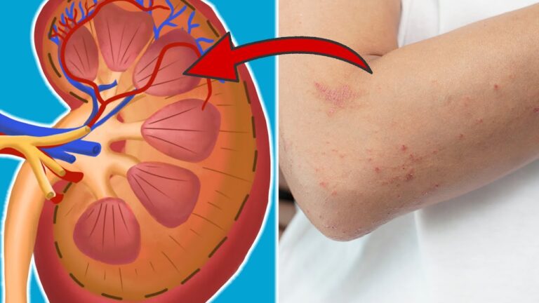 7 Signs Your Kidneys Need Urgent Help – Don’t Ignore These 5 Warning Symptoms!
