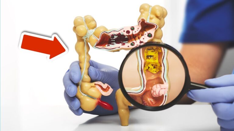5 Tips to Keep Your Gut Healthy and Happy for a Better You! 🌟