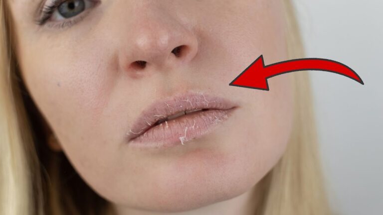5 Unusual Signs of Iron Deficiency You Should Never Ignore! Discover Them Now!