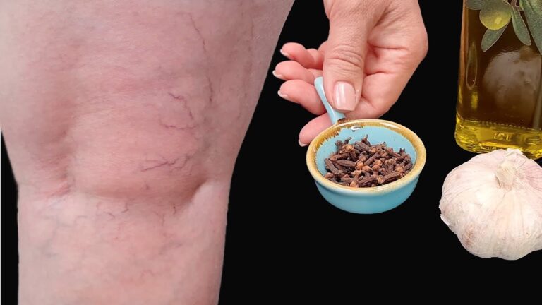 10 Natural Remedies to Relieve Joint Pain and Boost Mobility Today!
