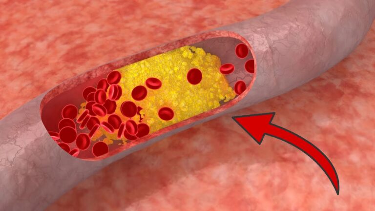 9 Surprising Foods to Cleanse Your Arteries for Better Health!